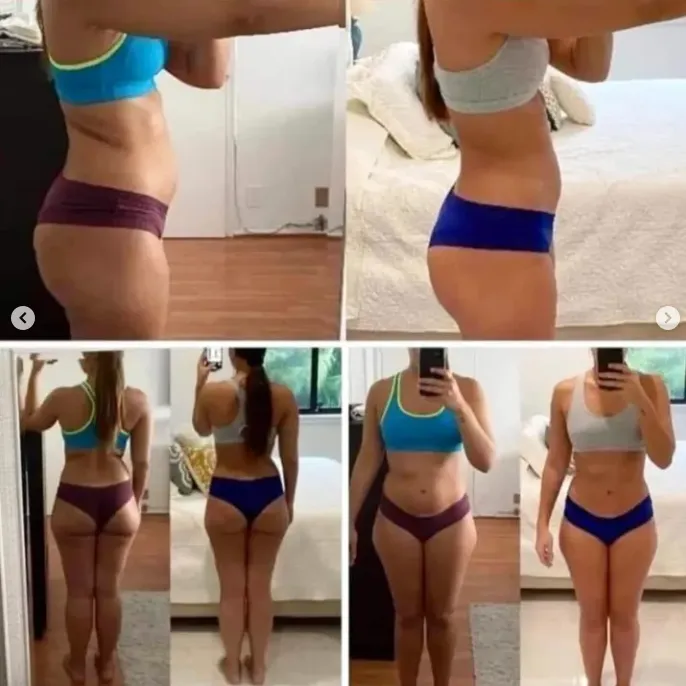 Fotos de seguimiento (antes y después) de una paciente de Consultorios DAG en manejo de peso, de perfil y de espalda